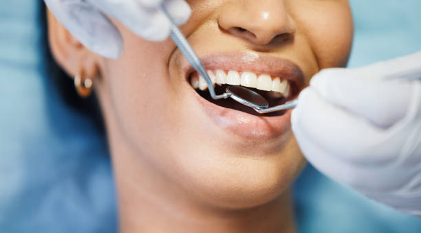 Best Emergency Dental Extractions in Port Townsend, WA