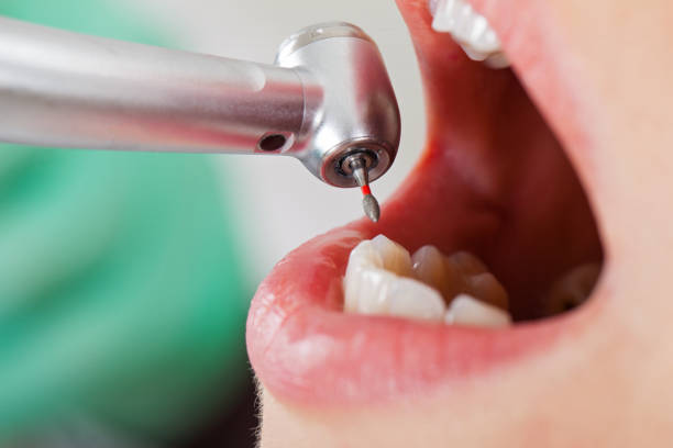 Best Pediatric Emergency Dentist in Port Townsend, WA